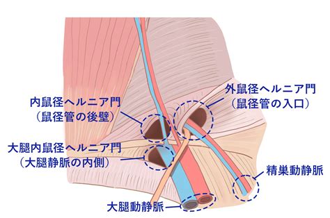 水戸 鼠径部|鼠径ヘルニア（総論）に関連する診療科の水戸市の病院・クリ。